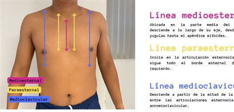 Actividad Lineas Y Regiones Del T Rax