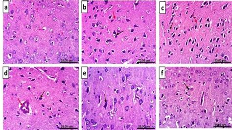 Histological H E Stained Sections Of Cerebral Cortex A Control Rat