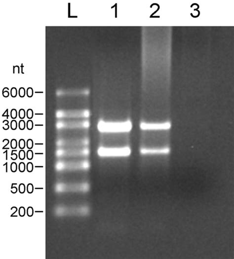 Native Agarose Gel Electrophoresis Of Total Rna Extraction From E Coli Download Scientific