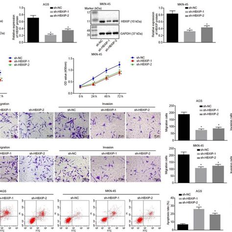 Silencing Hbxip Inhibits Gc Cell Viability Migration And Invasion And Download Scientific