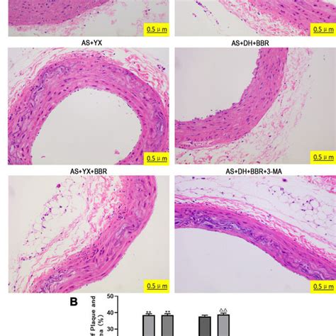 The Histology Analysis Of The Rat Aortic Tissues A He Staining Of Download Scientific