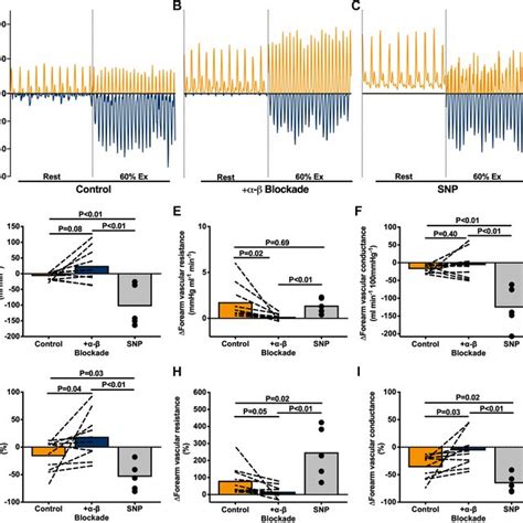 Active muscle perfusion during exercise-induced vasoconstriction. A and ...