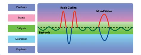 Rapid Cycling And Mixed States In Bipolar Disorder Download