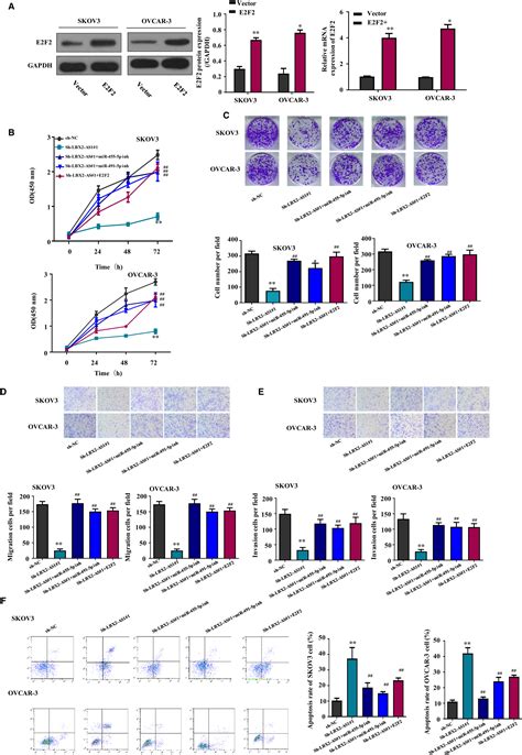 Lbx As Promotes Ovarian Cancer Progression By Facilitating E F Gene