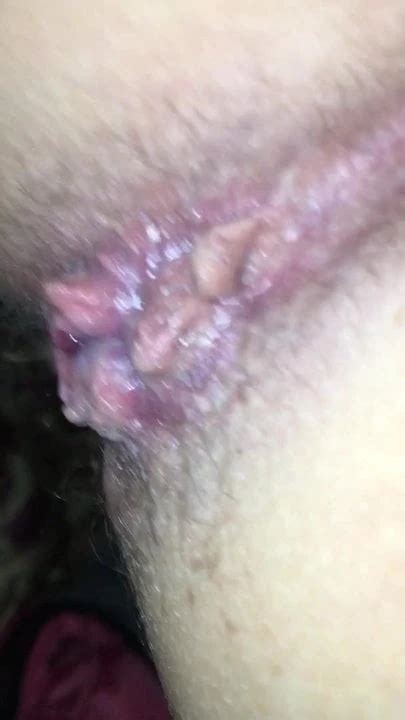 Pusi Austrian Anal Anal Porn XHamster