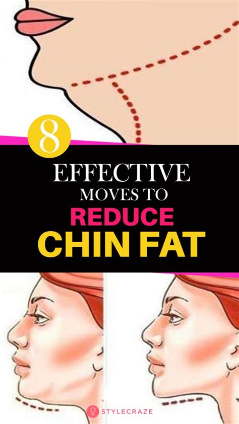 How To Reduce Double Chin With 8 Exercises 9 Remedies And Diet How