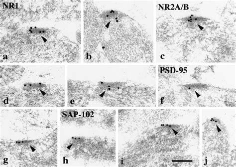 Immunogold Labeling 10 Nm Gold Of Nr1 A B Nr2ab Ce