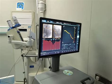 Ffr新技术，开启冠脉精准介入治疗“心”时代巩义市总医院