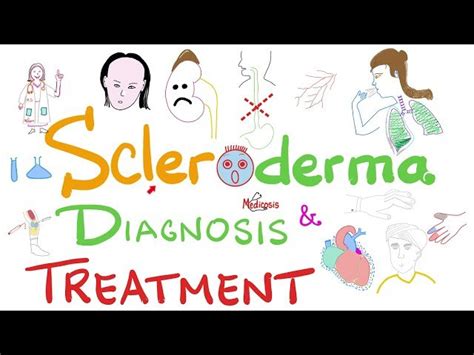 Free Video: Scleroderma Diagnosis and Management from Medicosis ...