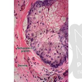 Man Sebaceous Gland Vertical Section X Sebaceous Gland