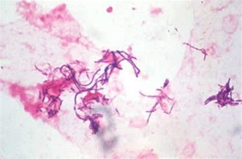 Multimedia Erysipelothrix Rhusiopathiae Gram Stain Merck Veterinary