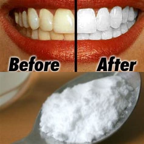 5 Minutes To A Brighter Smile: At-Home Teeth Whitening Secrets