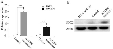 Ectopic Expression Of SOX2OT In MDA MB 231 Cells A Relative