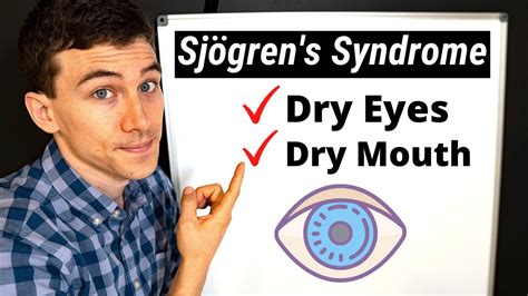 What Is Sjögren's Syndrome? Eye Doctor Explains