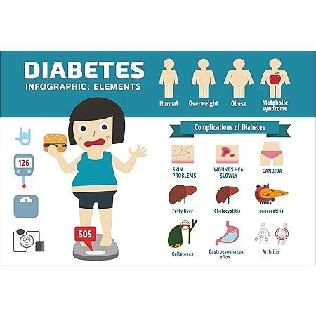 Anne Print Solutions Diabetes Infographic Poster Without Frame For