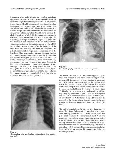 Pdf Ipsilateral Reexpansion Pulmonary Edema After Drainage Of A