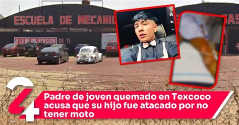 Padre De Joven Quemado En Texcoco Acusa Que Su Hijo Fue Atacado Por No