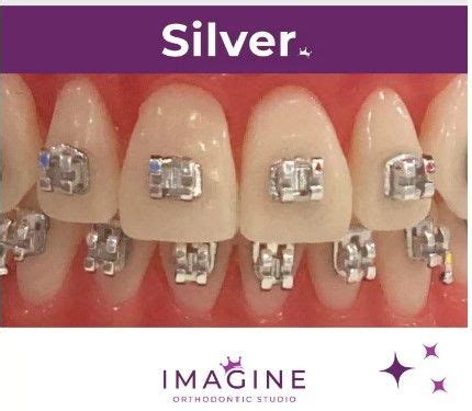 What Makes Us Different Imagine Orthodontic Studio