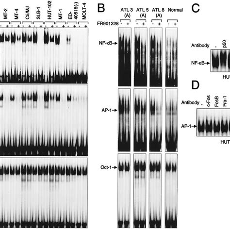 Inhibition Of Constitutive Nf B And Ap 1 Activities In Htlv 1 Infected Download Scientific