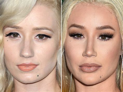 Iggy Azalea Before And After From 2012 To 2019 The Skincare Edit