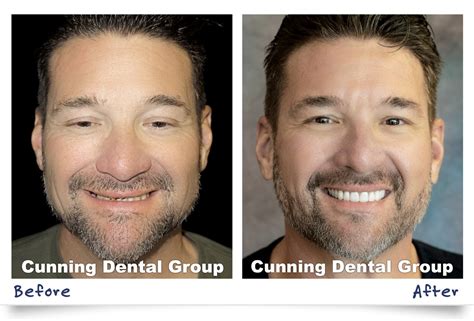 Cunning Dental Group Smile Gallery