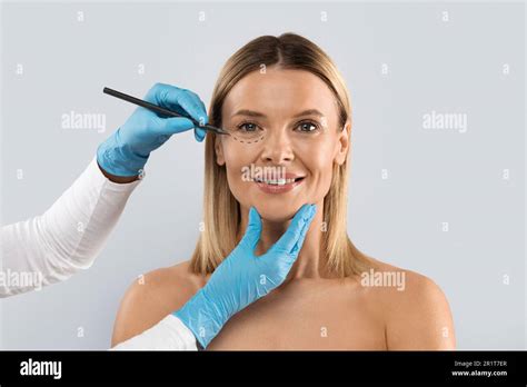 Surgeon Drawing Perforation Lines On Woman Face For Plastic Surgery