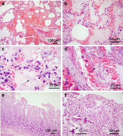 Representative Micrograph For Histopathological Findings In The Lungs