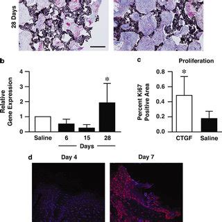 Proteomic Analysis Reveals Connective Tissue Growth Factor Ctgf