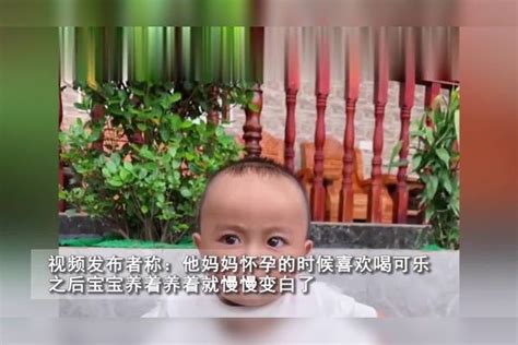 妈妈怀孕时爱喝可乐，宝宝出生竟黑成酱油色，耐心抚养后成功逆袭