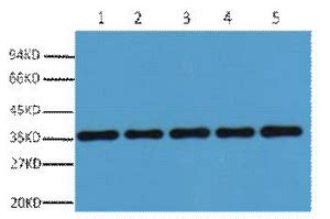 GAPDH Rabbit Polyclonal Antibody