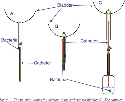 Figure 1 From The Pathogenesis Of Catheter Associated Urinary Tract