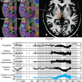 Schematic Overview Of The Study With Eeg Data Processing Pipeline