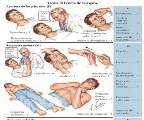 ANÁLISIS Y VALORACIÓN DE ENFERMERÍA ESCALA DE GLASGOW