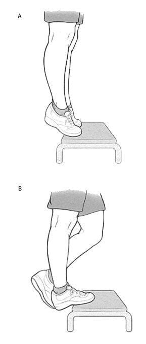 Midportion Achilles Tendinopathy Eccentric Exercises Show Promising