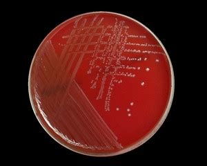 Enterococcus faecalis under microscope: microscopy of Gram-positive ...