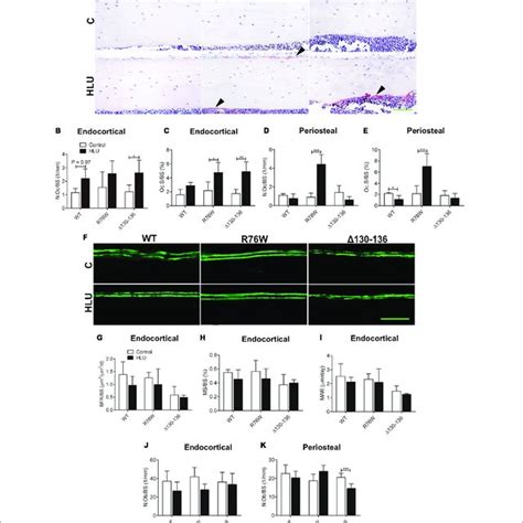 Hlu Affects Cortical Osteocyte Ranklopg And Sclerostin Expression In Download Scientific