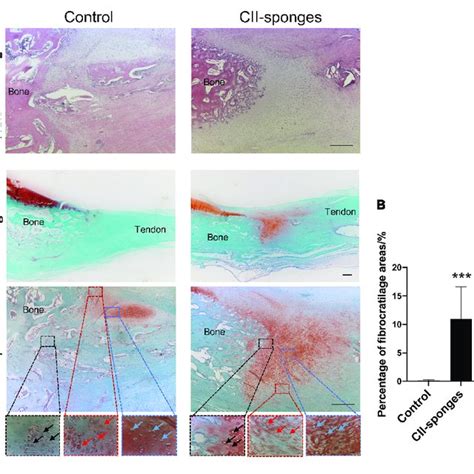 Histological Evaluation Of The Regeneration Of Fibrocartilage