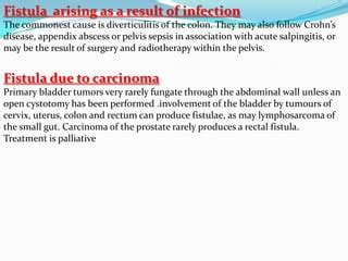 Bladder Stones Fistula Diverticulum Ppt