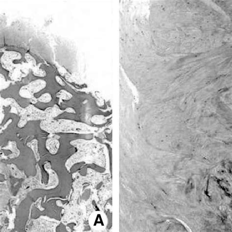 Low Power A H E Stain ×40 And High Power Histologic Examinations