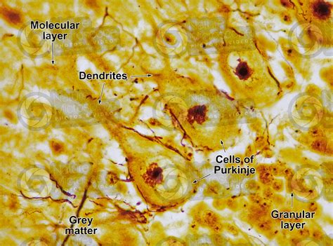 Mammal Cerebellum Sagittal Section 500X Cerebellum Mammals