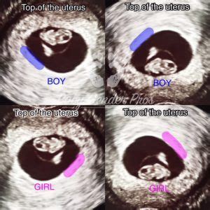 Ramzi Theory Gender Prediction Baby Gender Pros Baby Gender