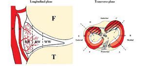 Meniscus Tears Wikism Sports Medicine Wiki