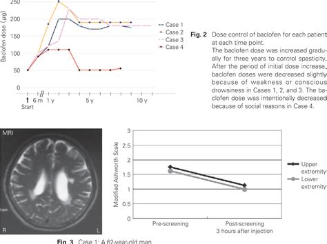 Figure 2 From Intrathecal Baclofen Therapy For Spasticity In Post