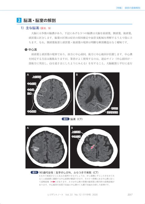 画像をダウンロード Ct Mri 違い イラスト 291362 Ct Mri 違い イラスト Freemuryodton8f