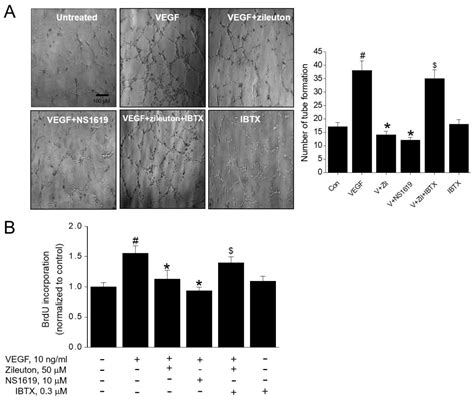 Cells Free Full Text Zileuton A 5 Lipoxygenase Inhibitor Exerts