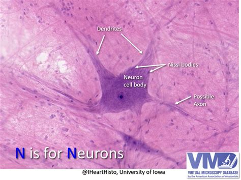 Motor Neuron Slide Labeled