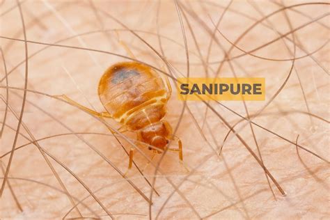 Comment Reconna Tre Une Morsure De Punaise De Lit Sanipure