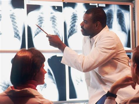 pemanfaatan ai  diagnosa penyakit  sulit dideteksi gitsid