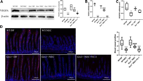 Hypoxia Inducible Factor 1α Stability Modified By Glutaredoxin 1 In