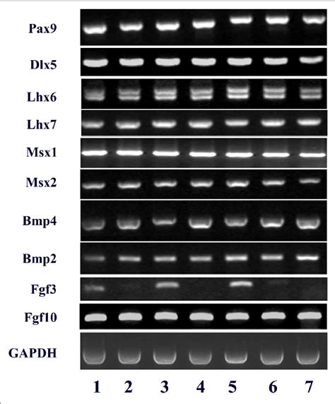 Rt Pcr Analysis Of The Expression Of A Series Of Gene Transcripts Download Scientific Diagram